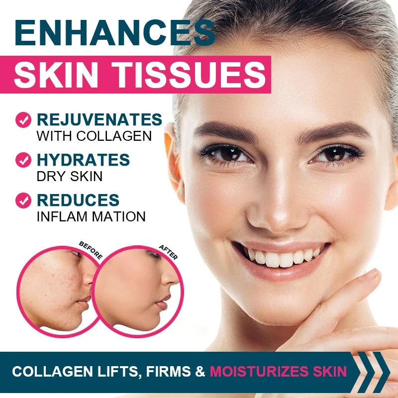 Multiple Collagen Complex
